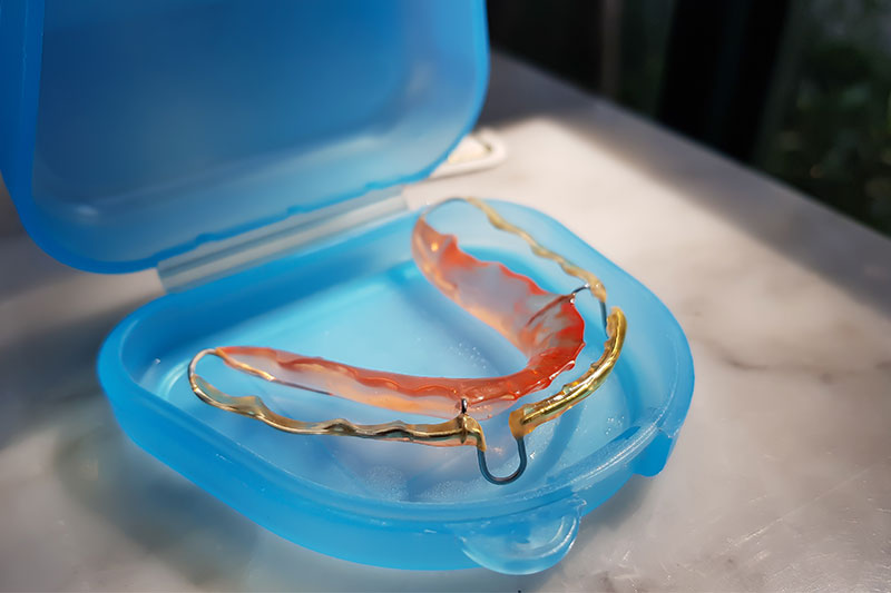 Retainers in Newton & Concord